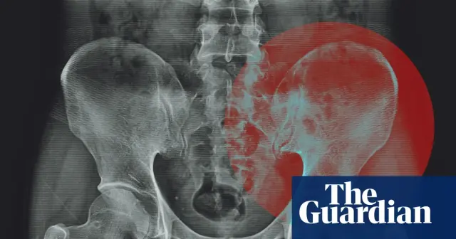 Experts debunk the myth that hips specifically store emotional trauma