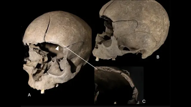 Archaeologists uncover child's skull embedded in 2,500-year-old Scandinavian house floor