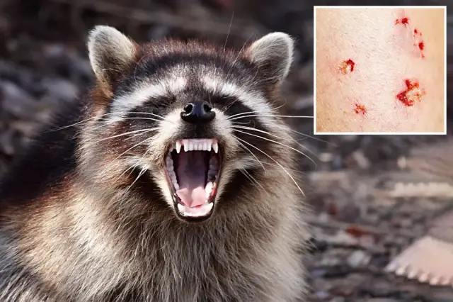 First Rabid Raccoon in LA County in 50 Years Triggers Public Health Alert