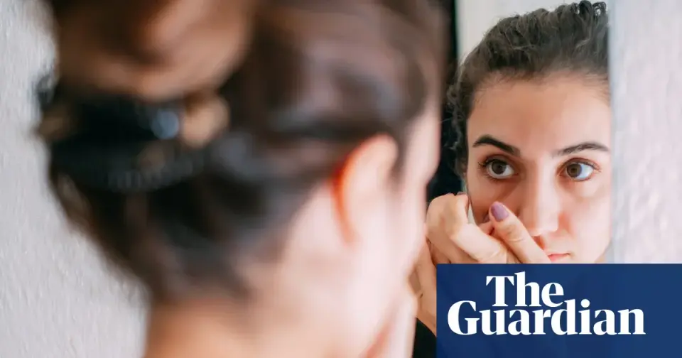 Experts debate 'ferritin face' trend: visual clues vs. medical reality