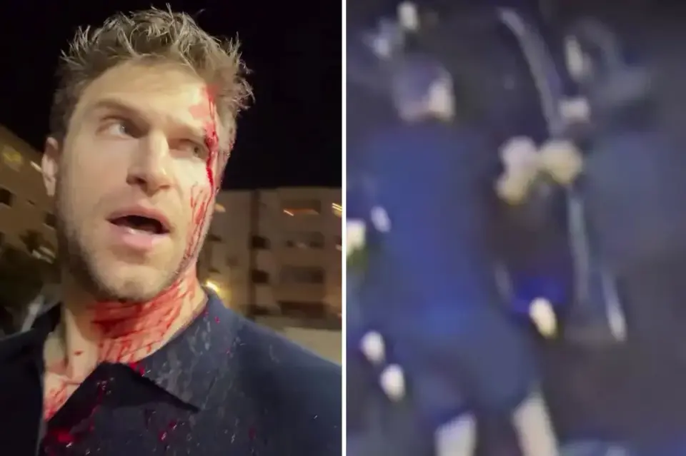 Actor Keegan Allen Hospitalized After Armed Robbery in West Hollywood