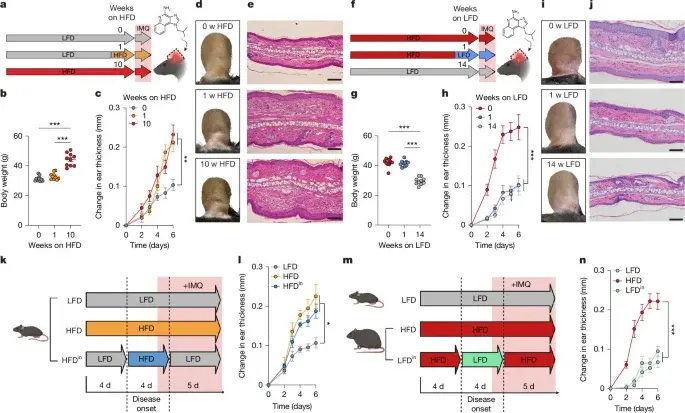 Brief High-Fat Diet Exposure at Disease Onset Creates Long-Lasting Inflammatory Memory