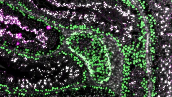 Meiosis-Targeted Breakthrough Moves Toward Reversible Nonhormonal Male Contraception