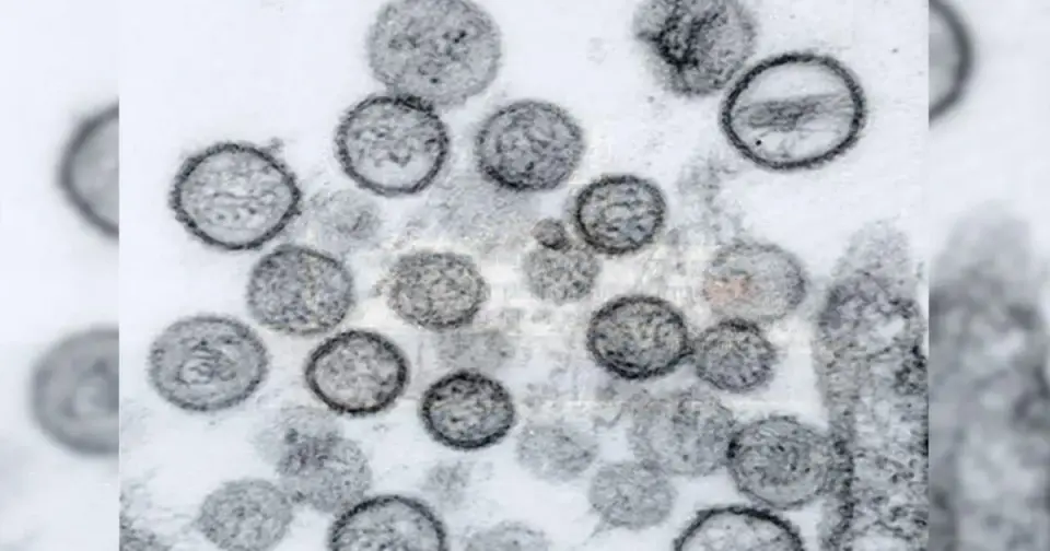 Hantavirus vs COVID-19: Distinct Origins and Public Health Realities