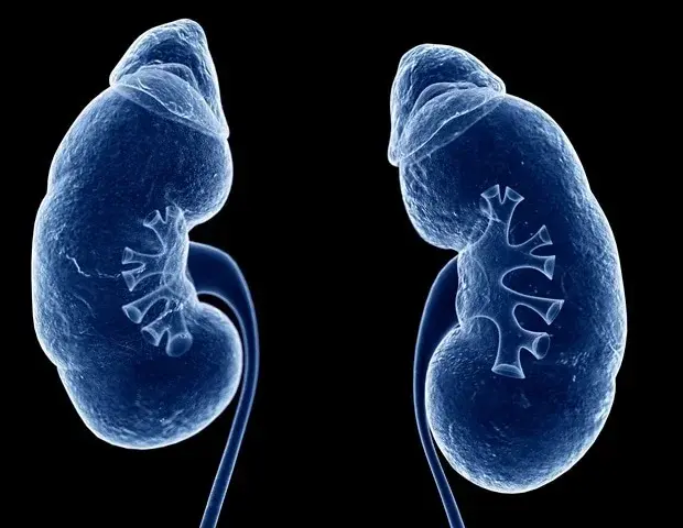 Cancer drug enables breakthrough kidney transplant for highly sensitized patient