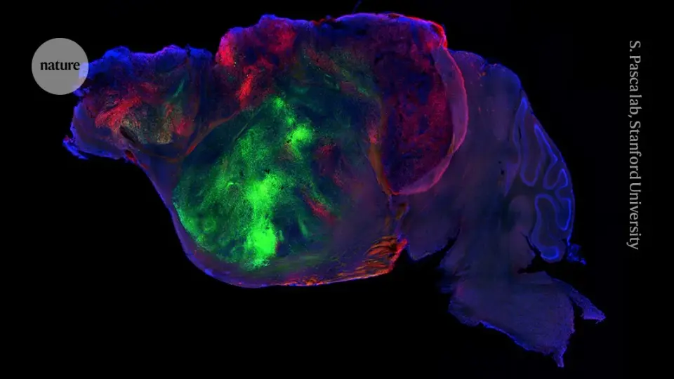 Human brain tissue fully integrates into mouse brains, opening new disease research avenues