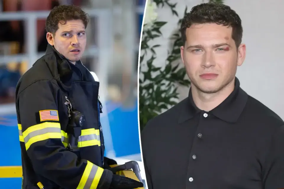Multiple '9-1-1' Cast and Crew Members Report Stunt-Related Injuries