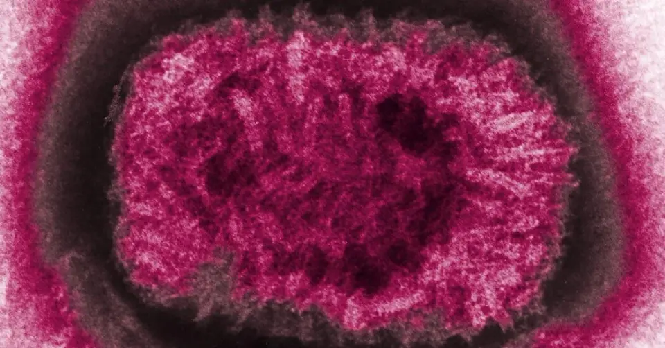 Ancient Smallpox Genomes Hint at Less Deadly Strains in 16th-Century Chile