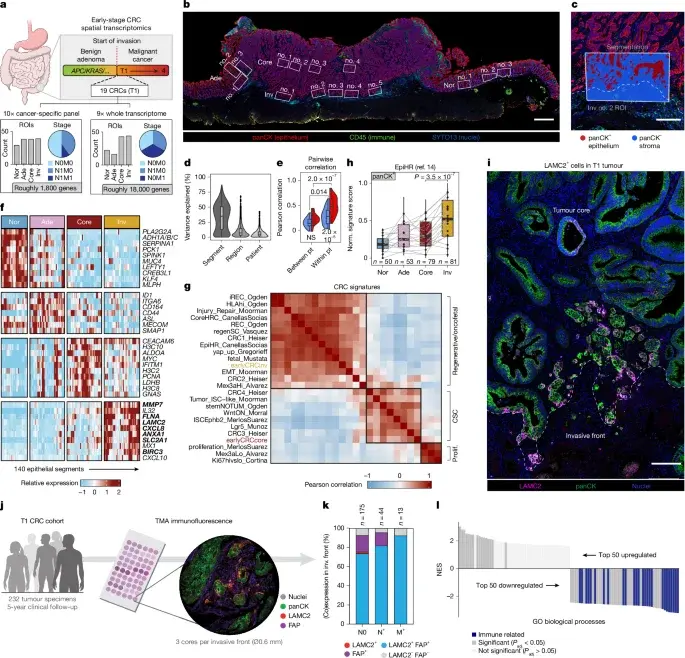 Submucosal fibroblasts drive early oncofetal plasticity at the invasive front in colorectal cancer