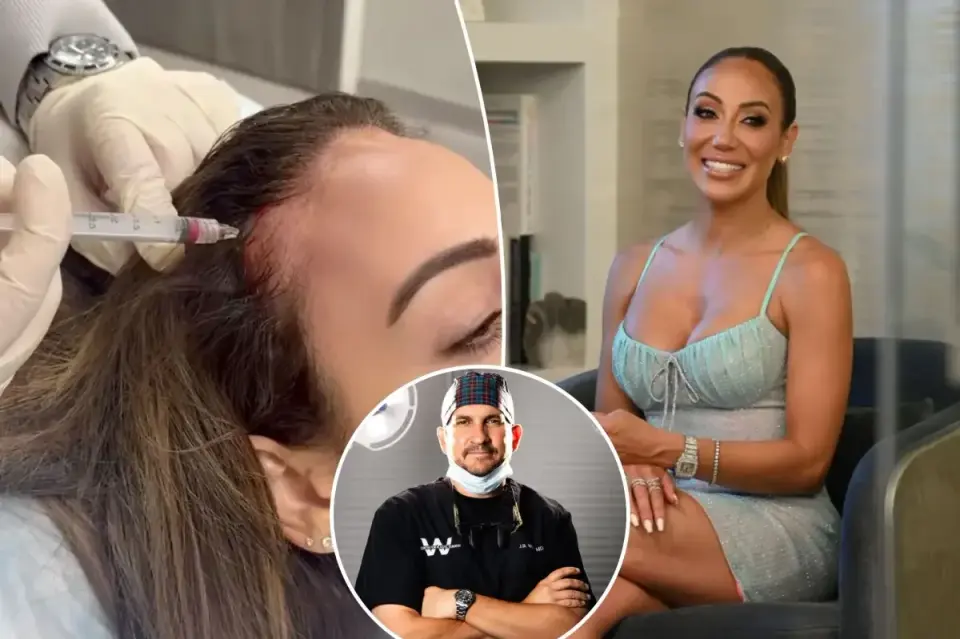 Melissa Gorga Uses PRP and Exosome Injections to Reverse Hairline Thinning