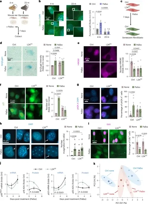 Aging Macrophages Fail to Clear 'Zombie' Cells Due to Decline in Protein Recycling