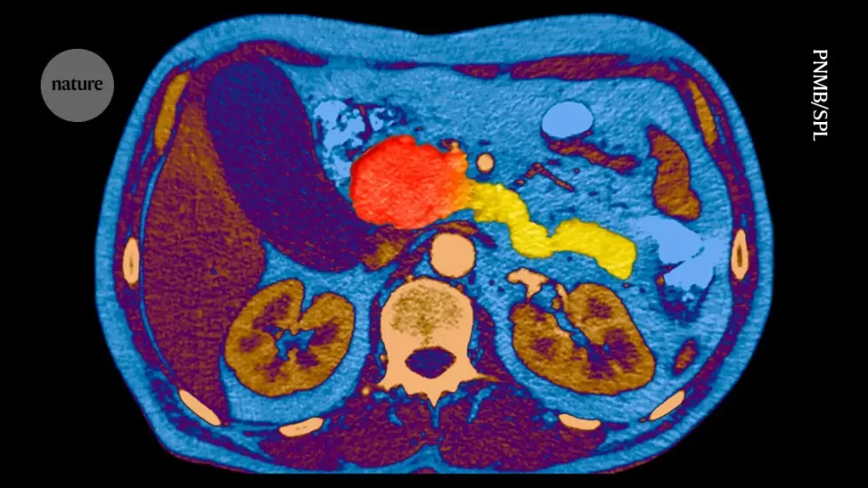 Breakthrough drug targets ‘undruggable’ cancer, doubles survival in pancreatic cancer