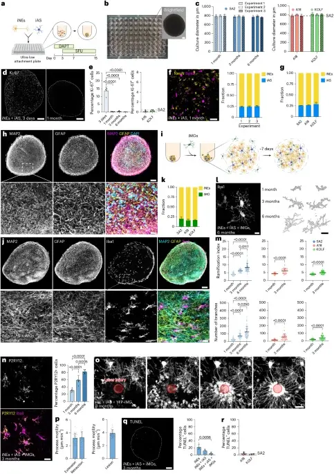 Reproducible 3D human brain tissue model reveals mature microglia and Alzheimer's disease hallmarks