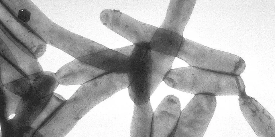 Legionella Detected in Ardsley’s Hot Water System, UWS Building Plans Disinfection