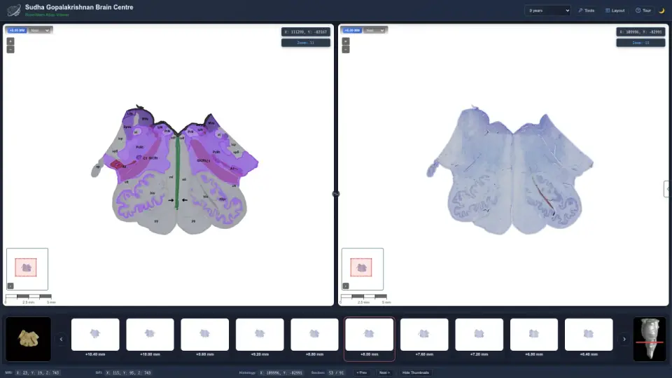 India Unveils the Most Detailed Brainstem Map Ever