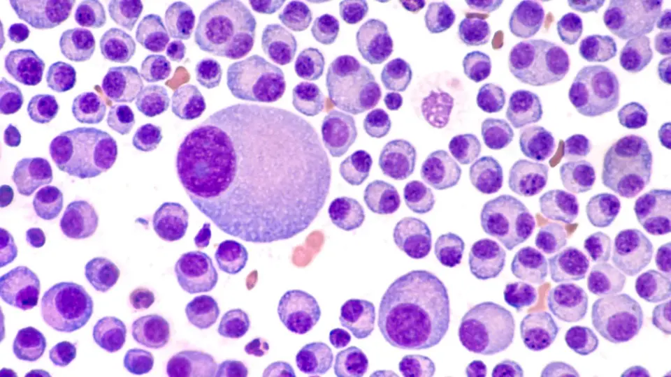 FDA approves Zenbexus, first-in-class therapy for advanced multiple myeloma
