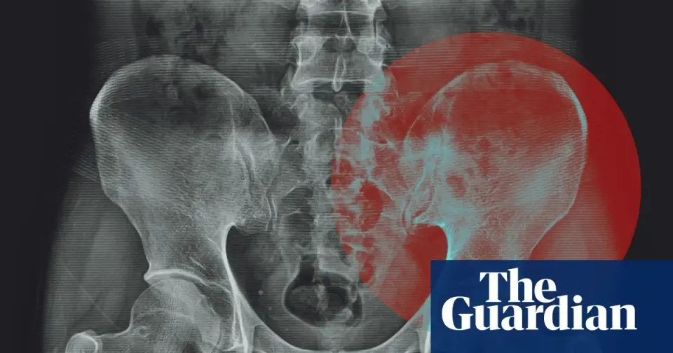 Experts debunk the myth that hips specifically store emotional trauma
