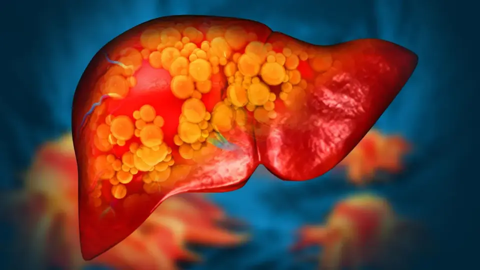 Michigan Medicine’s DT-109 Reverses Fatty Liver by Repairing Gut Barrier in Animal Trials