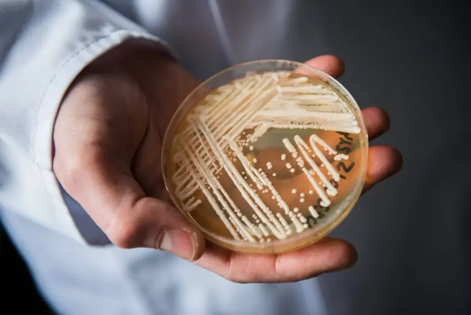 Candida auris detected across 27 states: key facts for the public