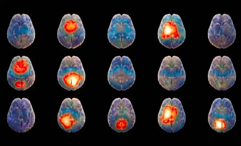 Israel AI Startup Promises 15-Minute Brain Disorder Diagnosis