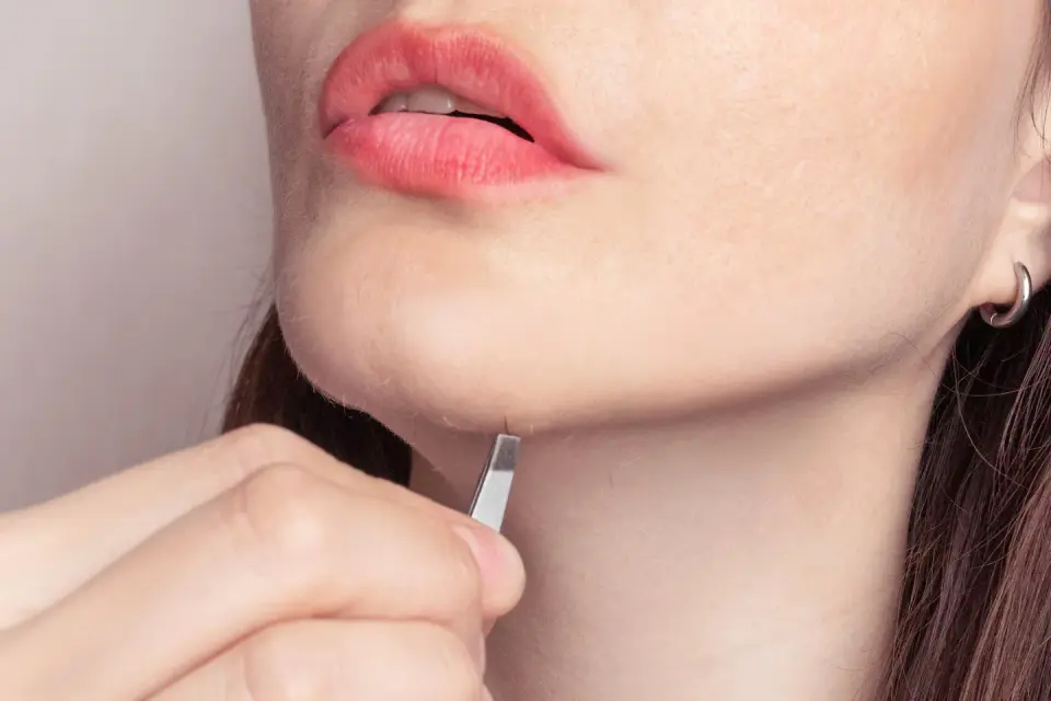 Why nearly half of women grow chin hair: Hormones, genetics, and treatments