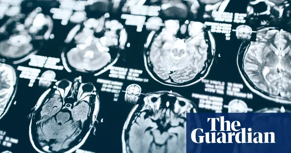 Funding Cuts Leave Pittsburgh Alzheimer’s Study Participants Without Results