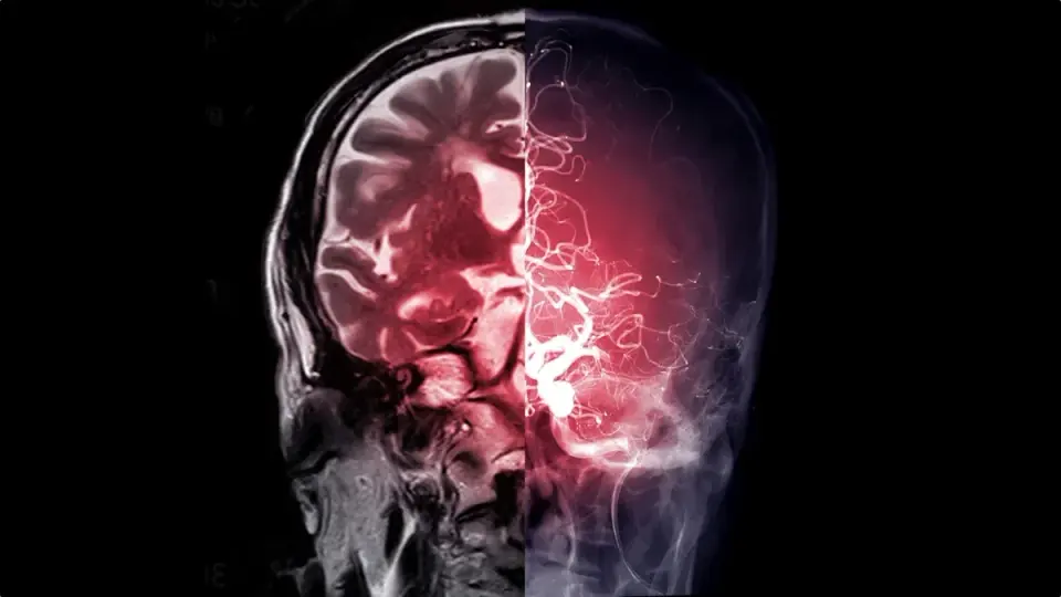 Metformin’s Brain Link: New Pathway Behind a 60-Year-Old Diabetes Drug