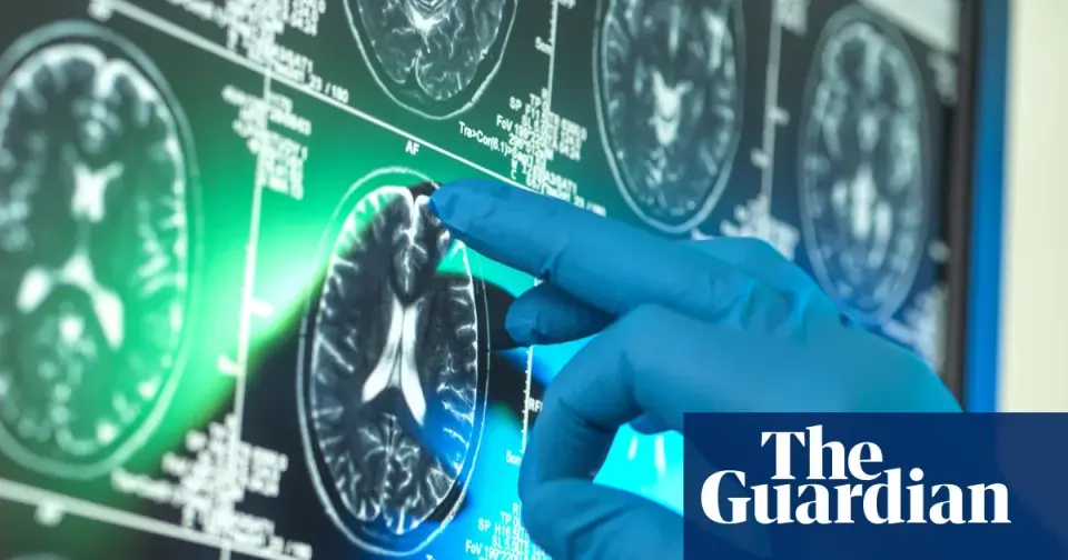 Alzheimer’s Research Cited in NIH Cancellations Amid DEI Debates