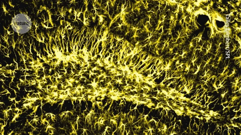 Brain enzyme PLA2G2F identified as key driver of cognitive resilience in aging