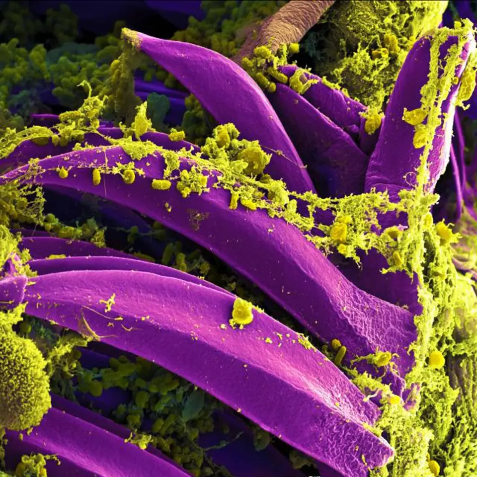 Russia Denies Plague Lab Accident as US Monitors Death of Siberian Researcher