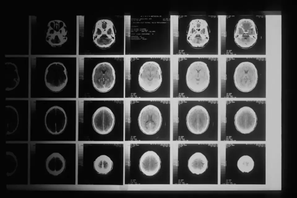 Brain Switch Uncovered That Could Prevent Alzheimer’s Memory Loss
