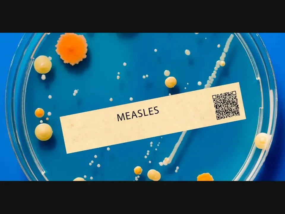Kaneland High School Reopens as Kane County Measles Investigation Continues