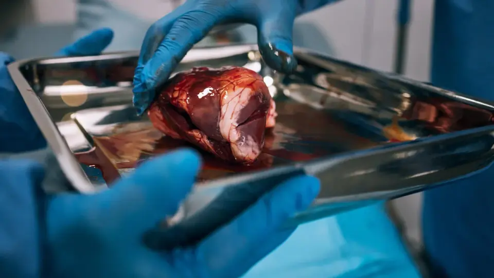 Pre-Waitlist Barriers Block Half of Kidney Transplant Candidates