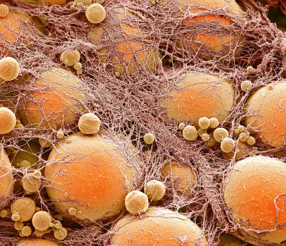 Fat Cells May Retain a 'Memory' of Obesity, Driving Rapid Weight Regain