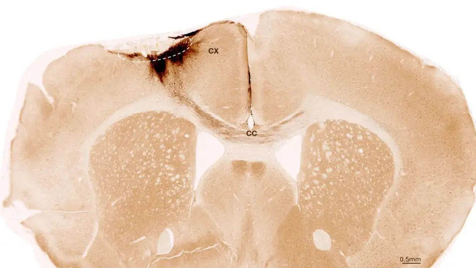 Zurich researchers report stem cell transplants restore motor function in stroke-affected mice