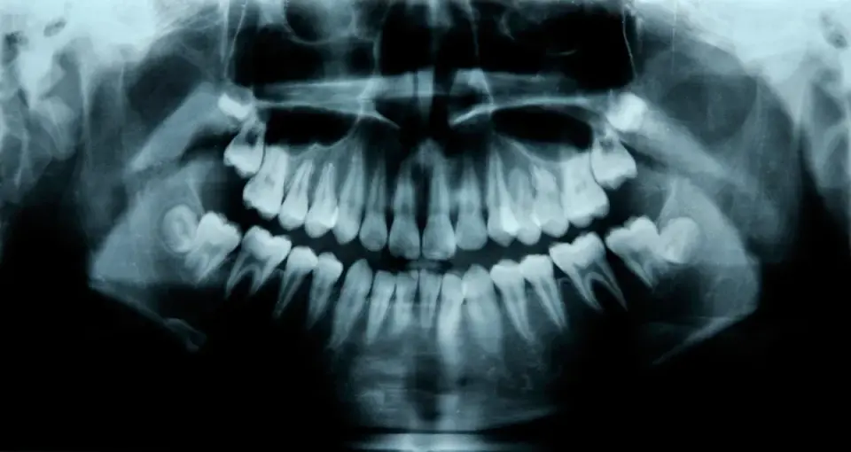Could Humans Grow a Third Set of Teeth? Early Trial Hints at Possibility