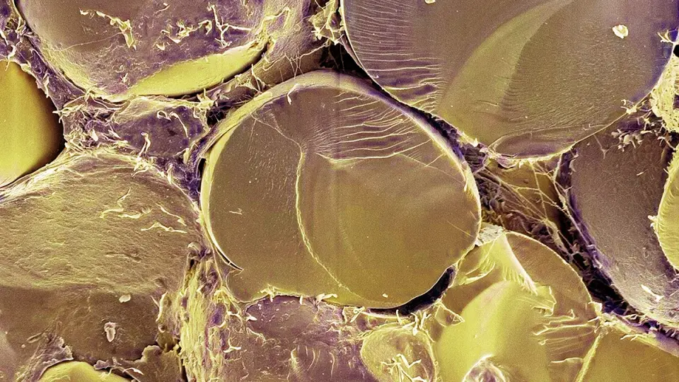 Mitch protein switch makes human cells burn fats for energy, opening obesity research avenue