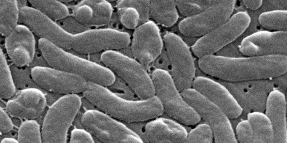 Louisiana Reports Five Vibrio Deaths This Year, Officials Warn