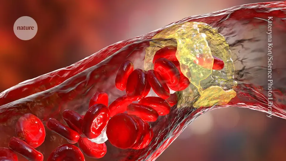 Gut Bacteria Identified as Natural Cholesterol Regulators in Heart Disease Research