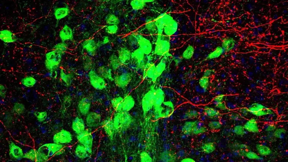 New Brain Circuit May Explain Tourette's and OCD Overlap