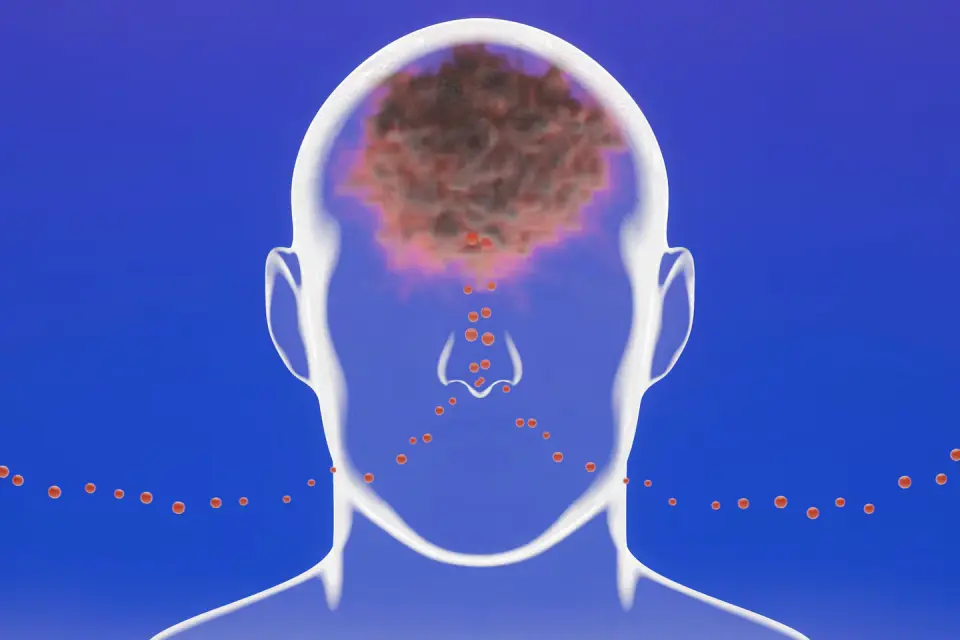 Airborne debris and neighborhood greenery emerge as key factors in brain health