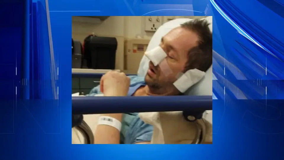 Rochester Motocross Rider Speaks Out on Fentanyl-Induced Sepsis and Permanent Nose Loss