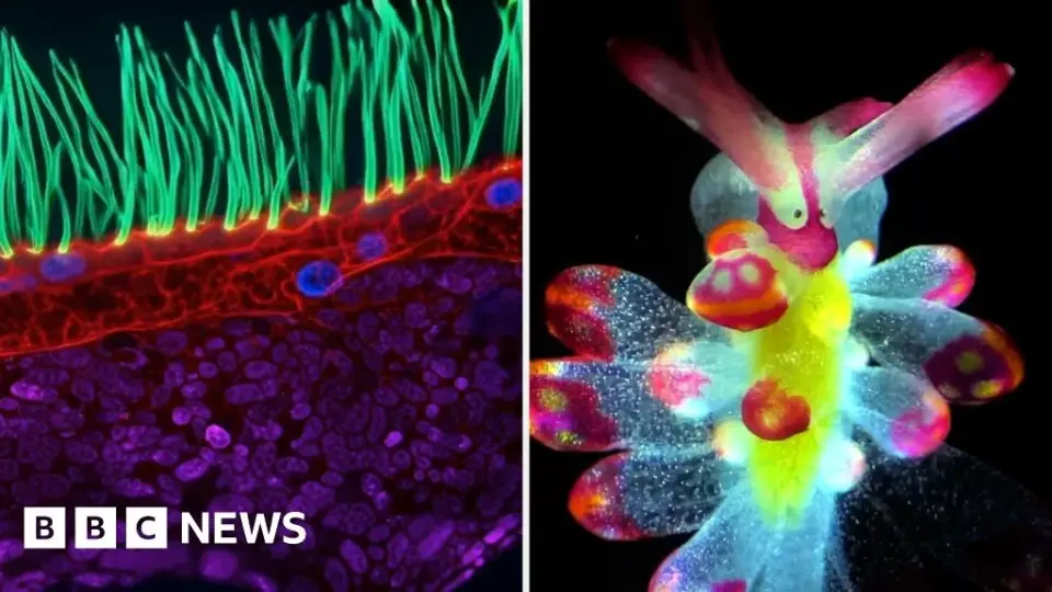 Cilia under the lens: 100x win for Nikon's Small World In Motion
