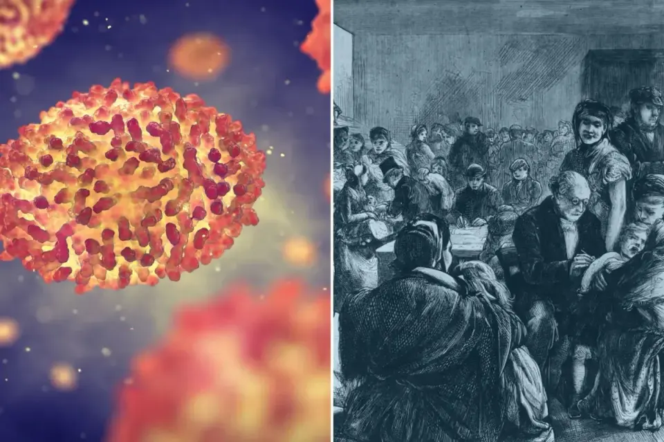 DNA from Chilean mummies confirms European smallpox reached the Americas