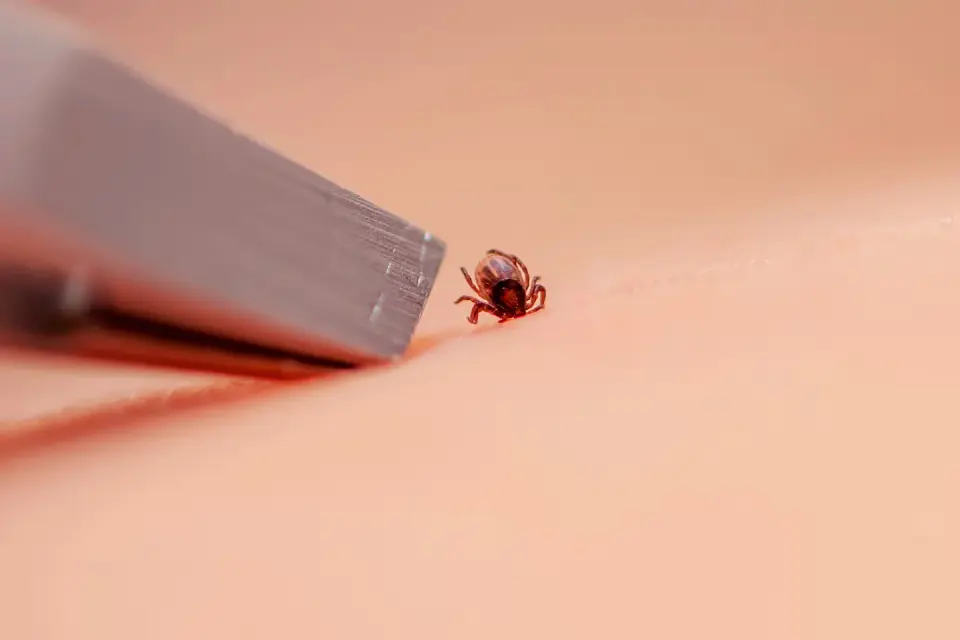 Tick bite playbook: safe removal and when to seek care