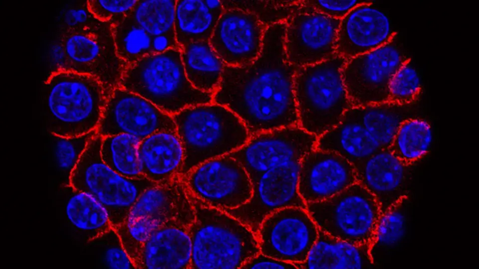 Pancreatic cancer drug duo shows durable responses, advancing to Phase 3