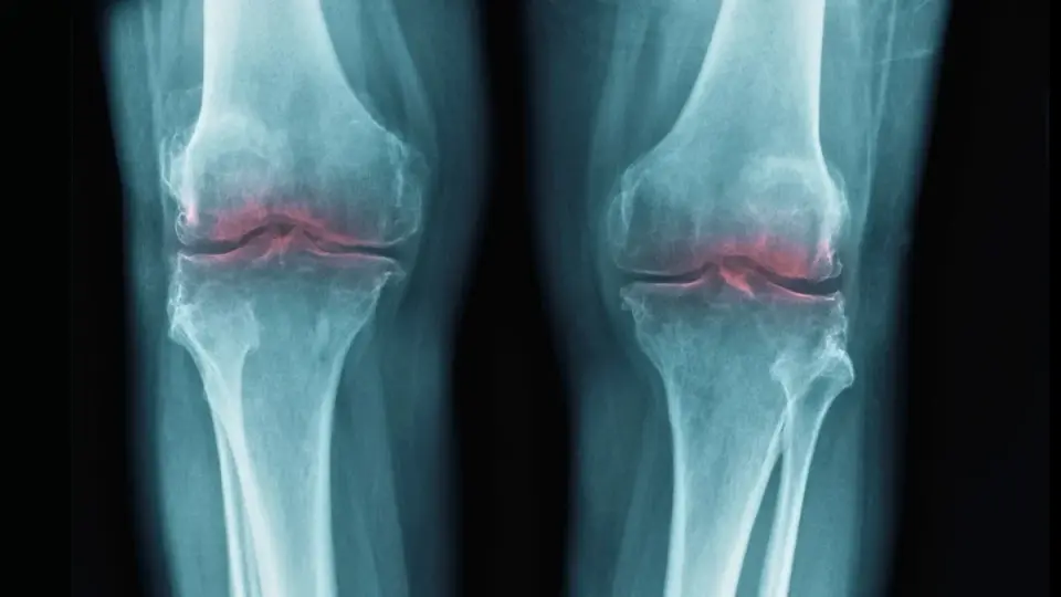 Aging Joint Breakthrough: Blocking 15-PGDH Rebuilds Cartilage