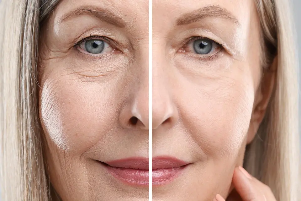 Not All Aging 'Zombie' Cells Are Bad: Precision Therapies Target Harmful Subtypes
