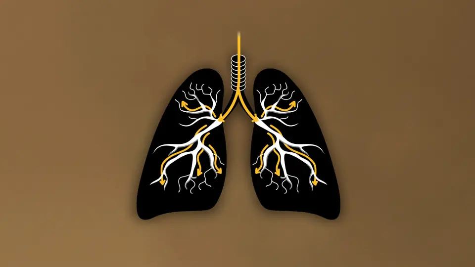 Wildfire Smoke: Tiny Particles, Big Health Risks for Lungs