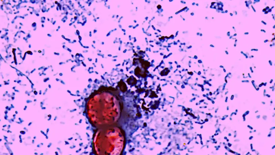 Cyclospora Outbreak Turns Deadly as Michigan Reports First Fatalities